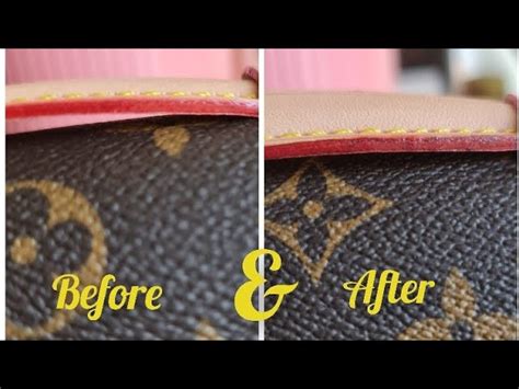 louis vuitton glazing issues|lv glazing peeling off.